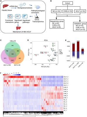 Human liver tissue transcriptomics revealed immunometabolic disturbances and related biomarkers in hepatitis B virus-related acute-on-chronic liver failure